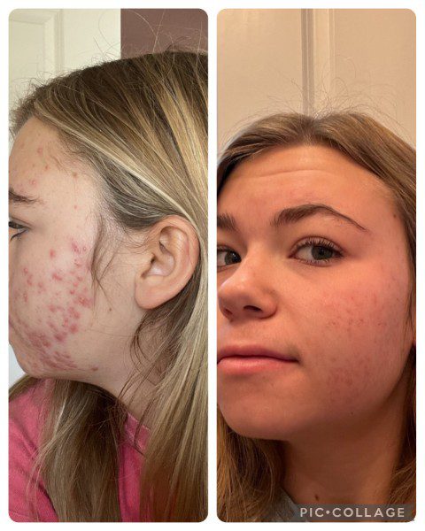 Skincare